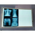 X Ray Viewer Negatoscope Film Viewer 3 Screen Ultra Bright LED Radiology LED X Ray Film Viewer
